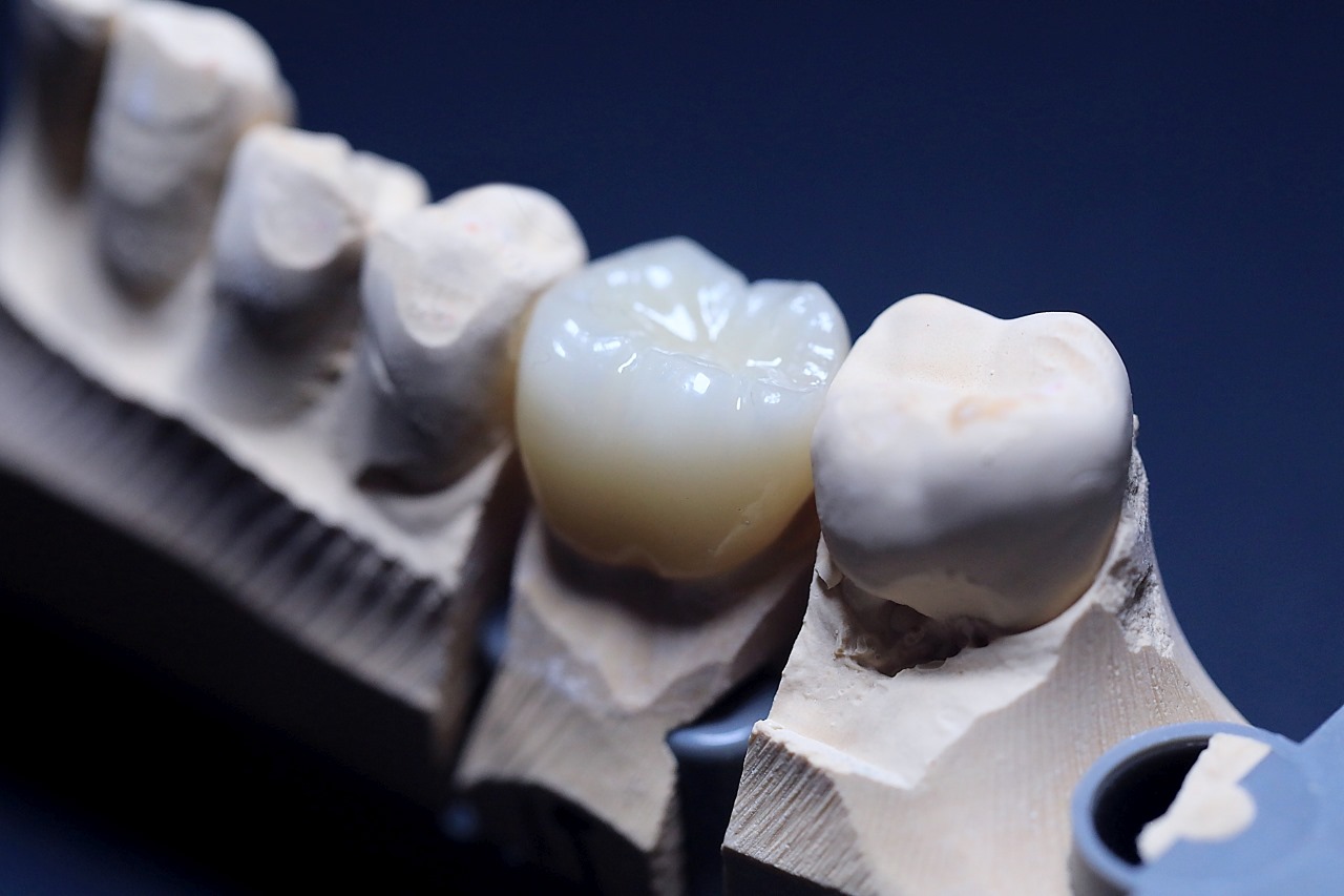Team Solutions Dental Lab