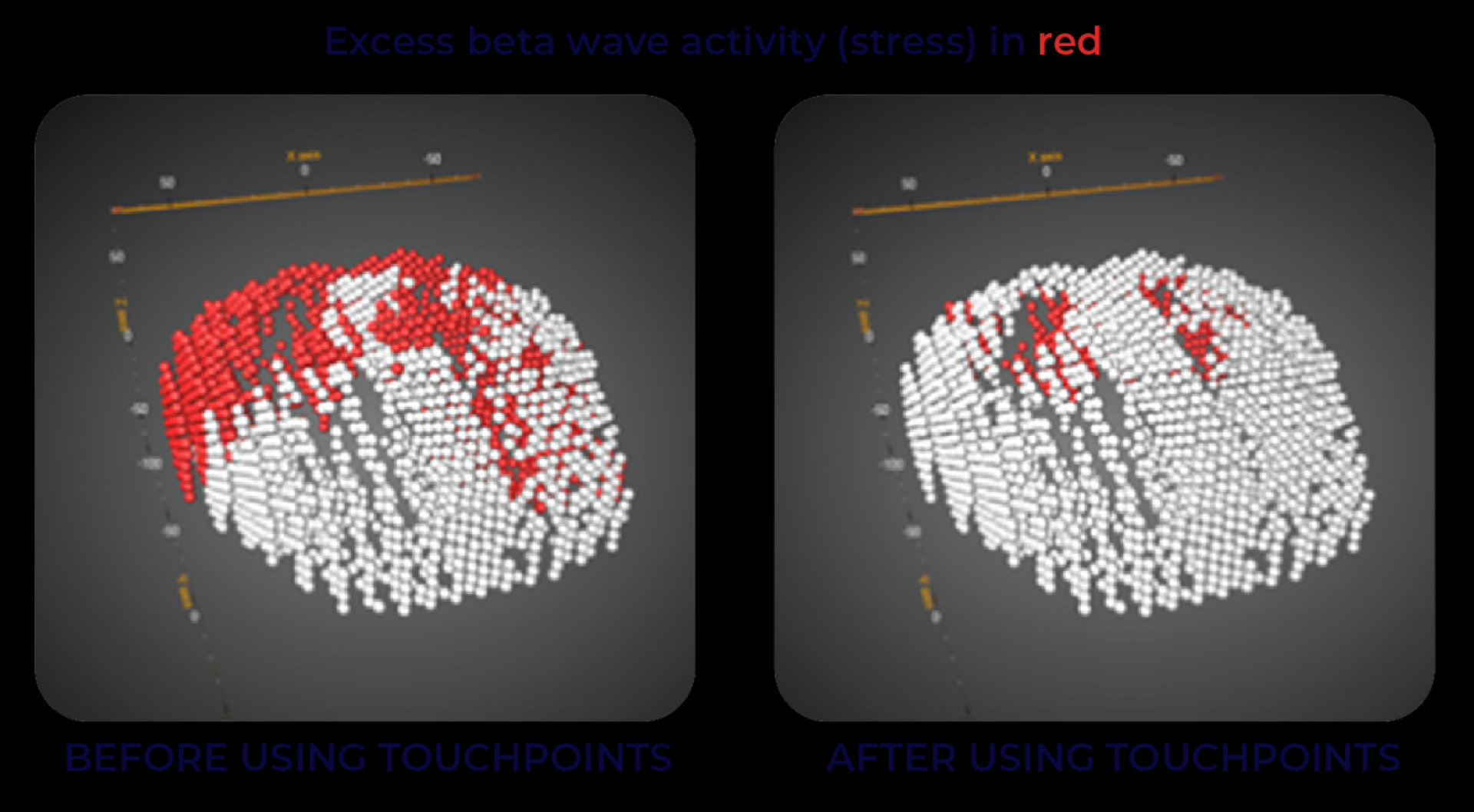 BLAST 70% of Stress Away in 30 Seconds